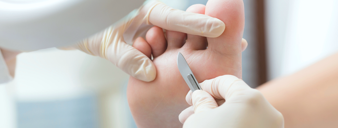 Stopy Biegacza: Fundament Twojego Treningu